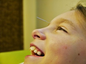 Treating Children with Acupuncure guildford surrey